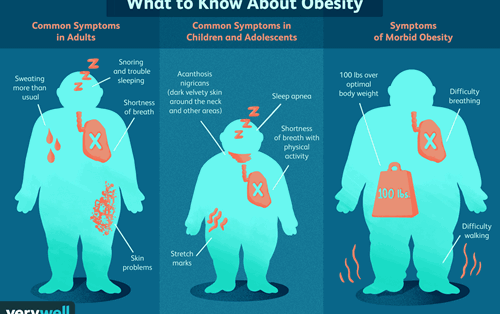 Causes of obesity: theories, conjectures and evidence